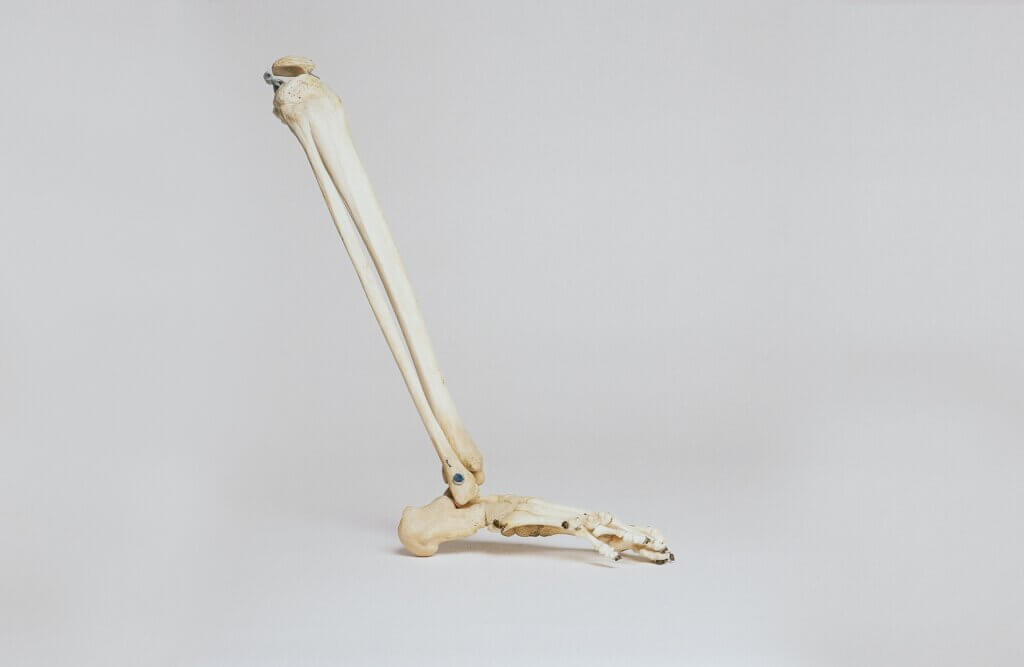 Image of bone from the knee down.